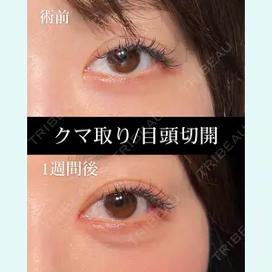 HAAB BEAUTY CLINIC 名古屋院 丸山 舜大医師の症例
