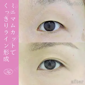 症例