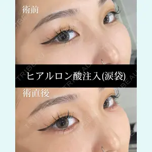 HAAB×DREAM BEAUTY CLINIC 大阪梅田院 錦 実奈医師の症例