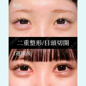 HAAB BEAUTY CLINIC 名古屋院 丸山 舜大医師の症例