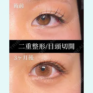 HAAB BEAUTY CLINIC 名古屋院 丸山 舜大医師の症例