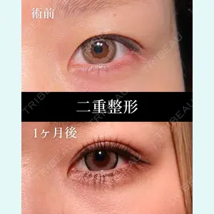 HAAB BEAUTY CLINIC 名古屋院 丸山 舜大医師の症例