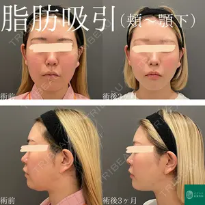 オアシス美容外科 遠藤 剛史医師の症例