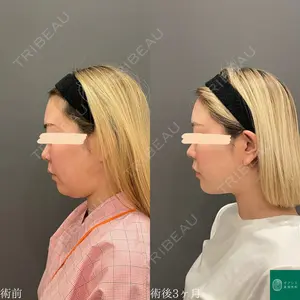 オアシス美容外科 遠藤 剛史医師の症例