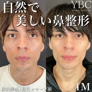 症例