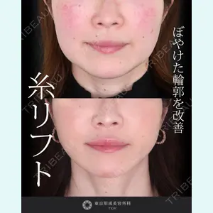 症例