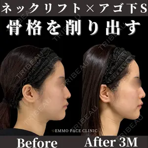 症例