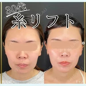 自由が丘ウェルエイジングビューティークリニック 福田 知佐子医師の症例