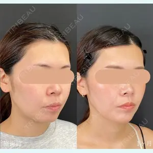 自由が丘ウェルエイジングビューティークリニック 福田 知佐子医師の症例