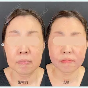 自由が丘ウェルエイジングビューティークリニック 福田 知佐子医師の症例