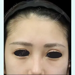 下北沢スキンクリニック 保坂 宗孝医師の症例