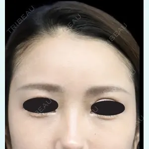 下北沢スキンクリニック 保坂 宗孝医師の症例