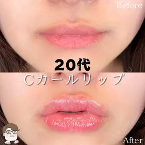 症例