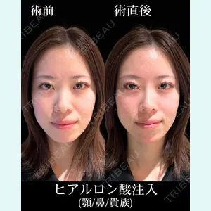 HAAB×DREAM BEAUTY CLINIC 東京本院 佐野 圭医師の症例