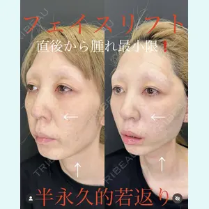 症例