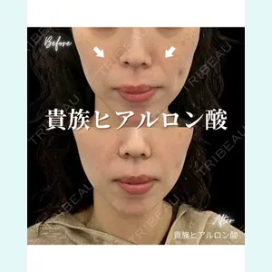 症例