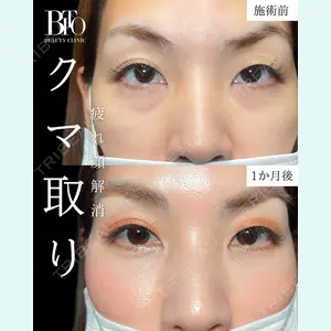 BITO BEAUTY CLINIC 伊藤 富良野医師の症例