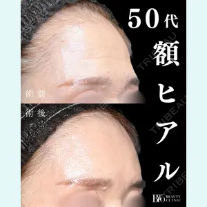 BITO BEAUTY CLINIC 伊藤 富良野医師の症例