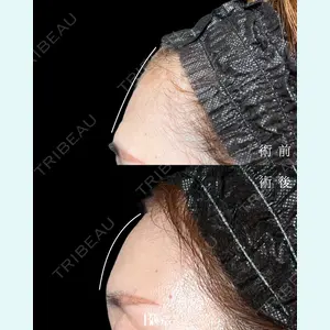 BITO BEAUTY CLINIC 伊藤 富良野医師の症例