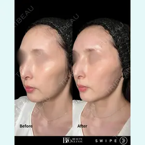 BITO BEAUTY CLINIC 伊藤 富良野医師の症例