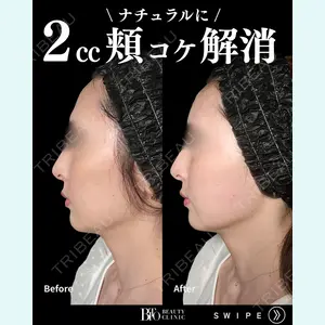 BITO BEAUTY CLINIC 伊藤 富良野医師の症例
