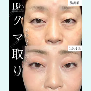 BITO BEAUTY CLINIC 伊藤 富良野医師の症例