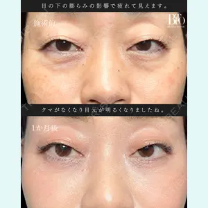 BITO BEAUTY CLINIC 伊藤 富良野医師の症例