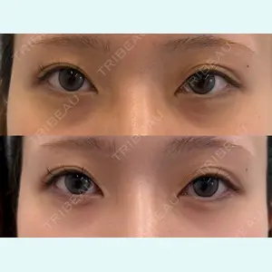 症例