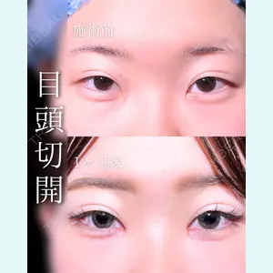 東京シンデレラ美容外科 池袋院 石井 達也医師の症例