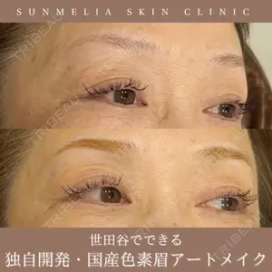 SUNMELIA SKIN CLINICの症例