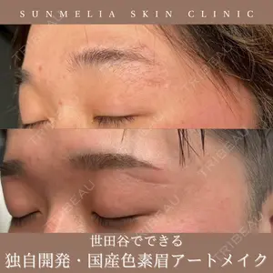 SUNMELIA SKIN CLINICの症例