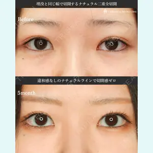 シンデレラ＆ダヴィンチクリニック 宮田 洋佑医師の症例