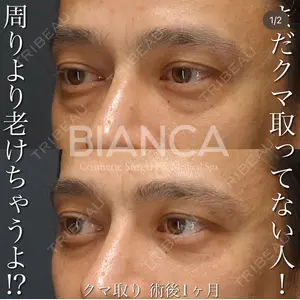 症例