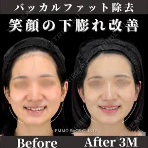 症例