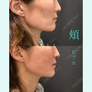 ルラ美容クリニック 千葉院 / ルラスキンクリニック 千葉院 松岡 舟作医師の症例