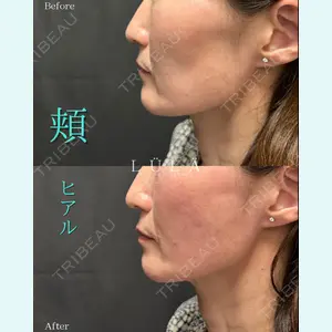 ルラ美容クリニック 千葉院 / ルラスキンクリニック 千葉院 松岡 舟作医師の症例