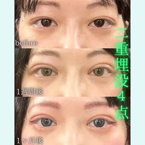 症例
