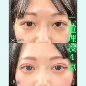 症例