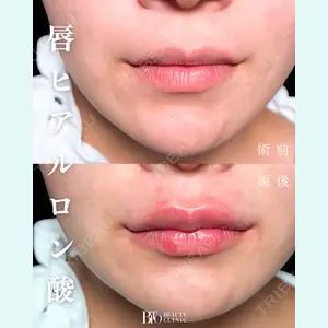 BITO BEAUTY CLINICの症例