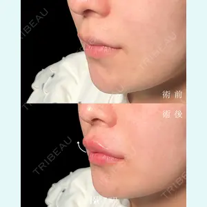 BITO BEAUTY CLINICの症例