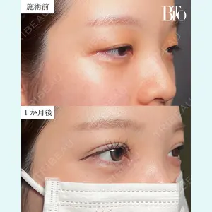 BITO BEAUTY CLINICの症例