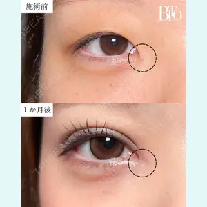 BITO BEAUTY CLINICの症例