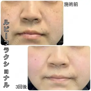症例
