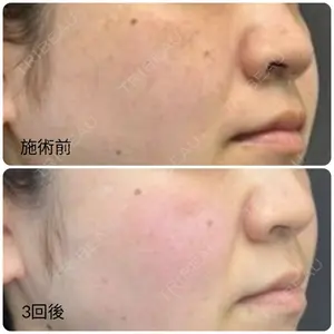 ゆきスキンクリニック 東池袋 小林 智之医師の症例