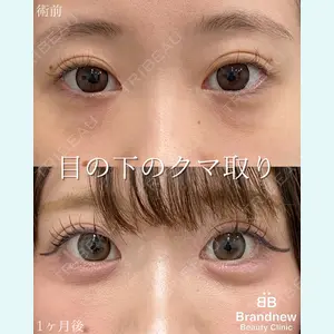 Brandnew Beauty Clinic 平山 容成医師の症例