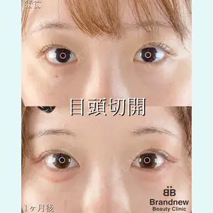 症例