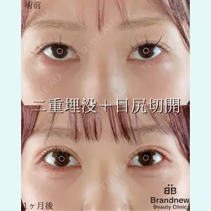 症例
