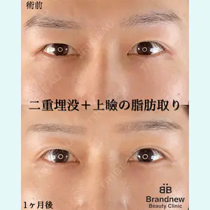 症例