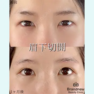 症例