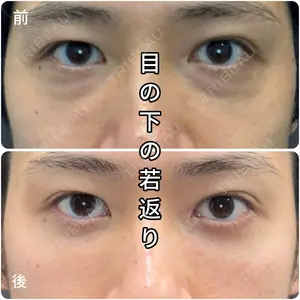 症例